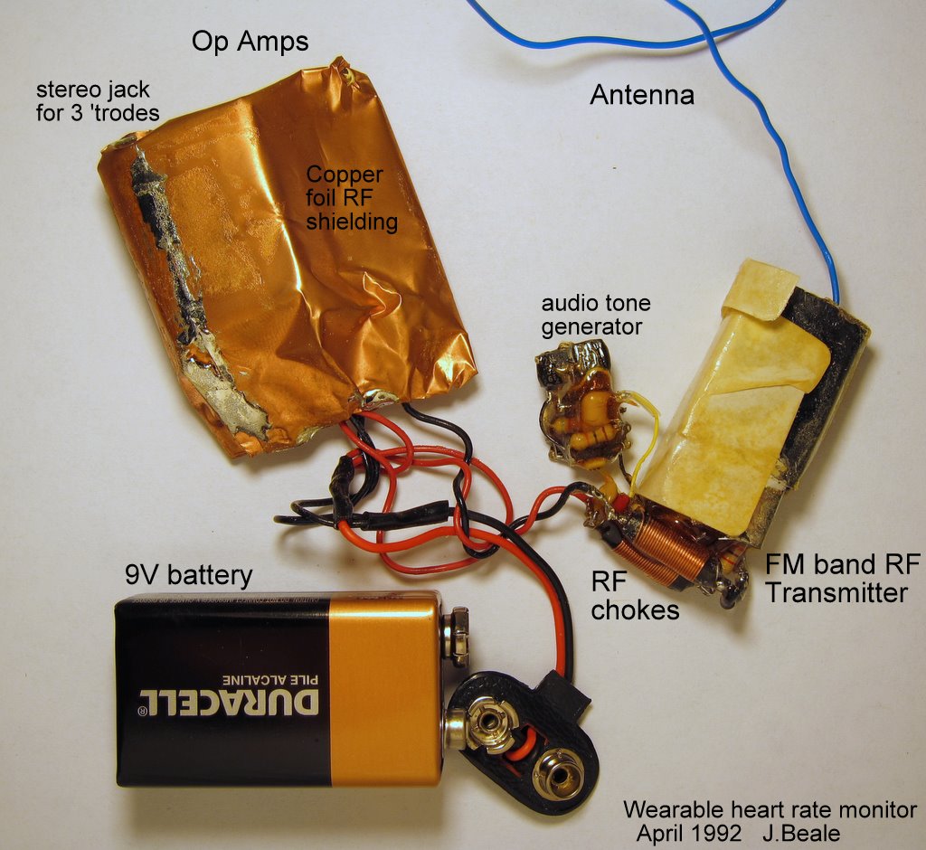 complete EKG circuit